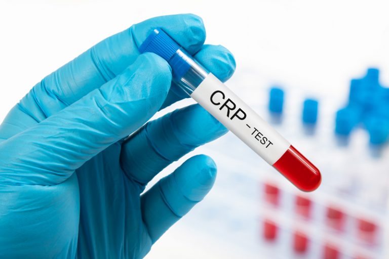 CRP檢查-發炎性腸道疾病